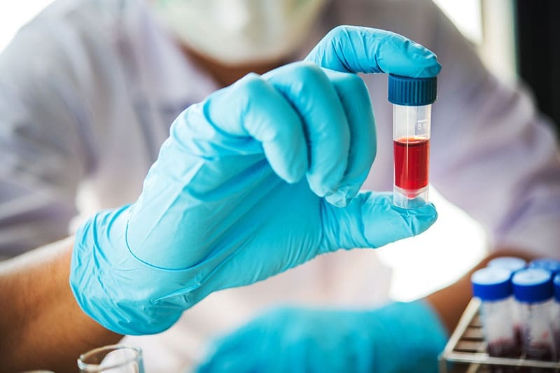 Ein Laborant hält eine Blutprobe in der Hand