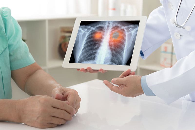 Ein Röntgenbild zeigt Lungen